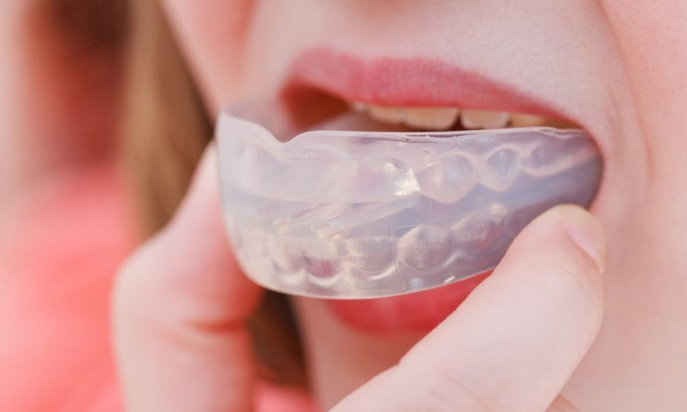 Dental Mouthguards in Northmead